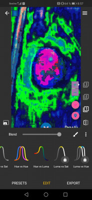 Screenshot_20230818_085704_com.foreachi.photocurves.jpg